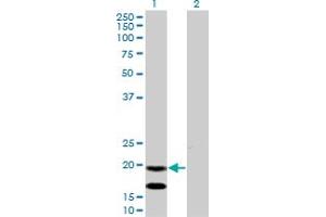 Western Blotting (WB) image for anti-Epithelial Membrane Protein 3 (EMP3) (AA 1-164) antibody (ABIN598660) (EMP3 antibody  (AA 1-164))