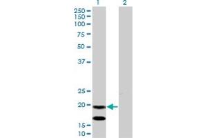 Western Blotting (WB) image for anti-Epithelial Membrane Protein 3 (EMP3) (AA 1-164) antibody (ABIN598660)