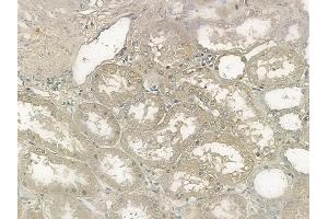 ABIN6256074 and ABIN6267116 at 1/100 staining human normal kidney tissue by IHC-P.
