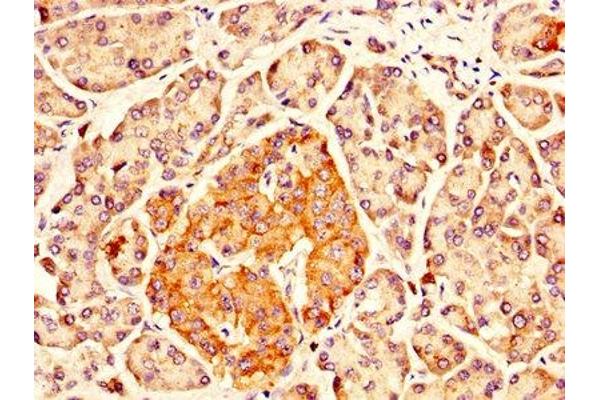 IDUA antibody  (AA 28-653)