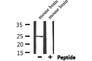 Western blot analysis of extracts from mouse brain, using CD9 Antibody.