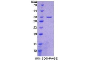 SDS-PAGE (SDS) image for Integrin alpha 1 (ITGA1) (AA 103-368) protein (His tag) (ABIN2125315)