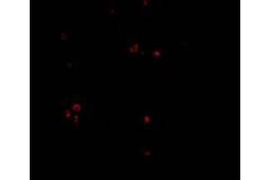 Immunofluorescence of MDA5 in Human Lymph Node cells with MDA5 Antibody  at 20 mg/ml (IFIH1 antibody  (Center))