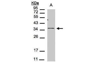 WB Image Sample(30 μg of whole cell lysate) A:293T 12% SDS PAGE antibody diluted at 1:1000 (CXCR6 antibody)