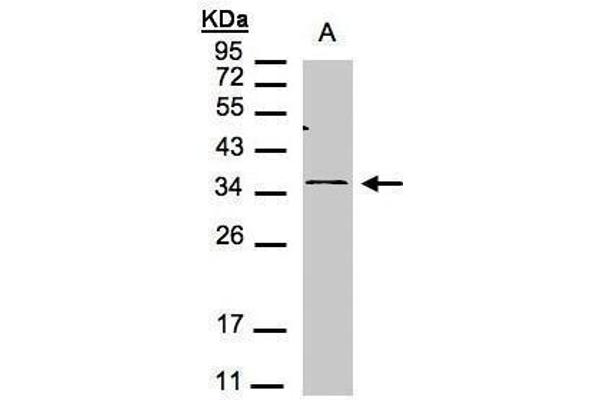CXCR6 antibody