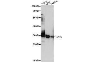 Western blot analysis of extracts of various cell lines, using CA5A antibody (ABIN6292754) at 1:1000 dilution.