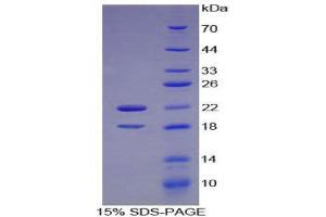 SDS-PAGE (SDS) image for Colony Stimulating Factor 2 Receptor, Alpha, Low-Affinity (Granulocyte-Macrophage) (CSF2RA) (AA 103-264) protein (His tag) (ABIN1170145) (CSF2RA Protein (AA 103-264) (His tag))