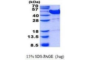 Figure annotation denotes ug of protein loaded and % gel used. (MVK Protein)