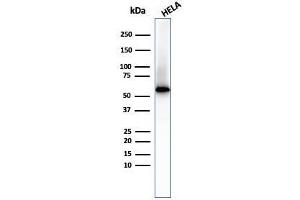 Western Blot of HeLa cell lysate Using Fascin-1 Mouse Monoclonal Antibody (FSCN1/417) (Fascin antibody)