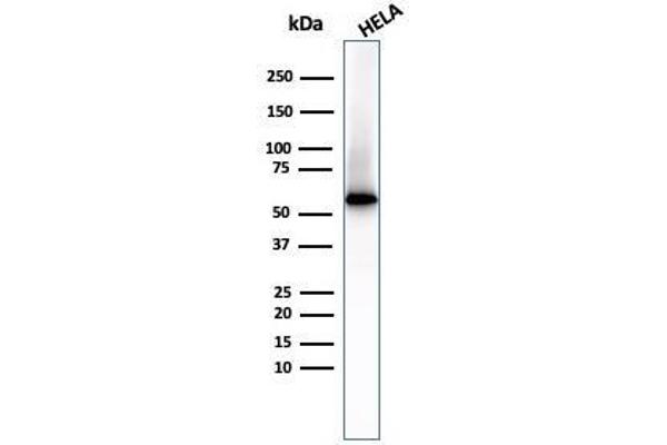 Fascin antibody