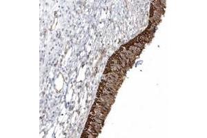 Immunohistochemical staining of human nasopharynx with DNAH1 polyclonal antibody  shows strong cytoplasmic and membranous positivity in respiratory epithelial cells at 1:200-1:500 dilution.