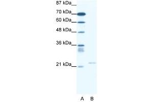 TRPM3 antibody used at 2 ug/ml to detect target protein.