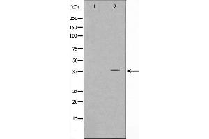 Western blot analysis on LOVO cell lysate using Synaptophysin Antibody,The lane on the left is treated with the antigen-specific peptide.