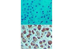 Image no. 1 for anti-Eukaryotic Translation Initiation Factor 4A1 (EIF4A1) (AA 350-400) antibody (ABIN960156) (EIF4A1 antibody  (AA 350-400))