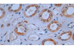 Immunohistochemistry (IHC) image for anti-HLA-DR-gamma (CD74) (AA 78-222) antibody (ABIN7443692)