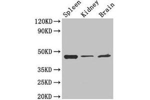 Western Blot Positive WB detected in: Mouse spleen tissue, Mouse kidney tissue, Mouse brain tissue All lanes: LAMP2 antibody at 4 μg/mL Secondary Goat polyclonal to rabbit IgG at 1/50000 dilution Predicted band size: 45, 46 kDa Observed band size: 45 kDa (LAMP2 antibody  (AA 54-268))