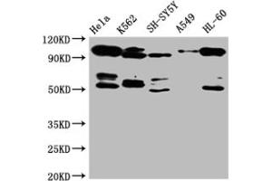 Western Blot Positive WB detected in: Hela whole cell lysate, SH-SY5Y whole cell lysate, K562 whole cell lysate All lanes: OFD1 antibody at 1:2000 Secondary Goat polyclonal to rabbit IgG at 1/50000 dilution Predicted band size: 117, 43, 112 kDa Observed band size: 117 kDa (OFD1 antibody  (AA 598-771))