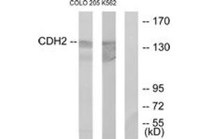 Western blot analysis of extracts from COLO205/K562 cells, using CDH2 Antibody. (N-Cadherin antibody  (AA 721-770))