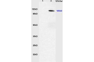 Lane 1: rat brain lysates Lane 2: human gastric carcinoma lysates probed with Anti phospho-CYLD(Ser418) Polyclonal Antibody, Unconjugated (ABIN683833) at 1:200 in 4 °C. (CYLD antibody  (pSer418))