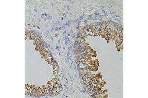 Immunohistochemistry of paraffin-embedded human prostate using TRPA1 antibody.