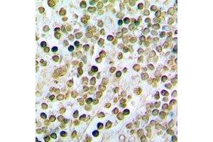 Immunohistochemical analysis of STAMBP staining in rat spleen formalin fixed paraffin embedded tissue section. (STAMBP antibody)