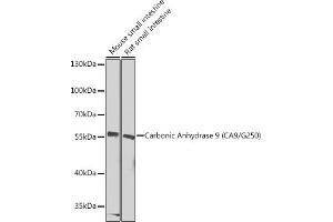Western blot analysis of extracts of various cell lines, using Carbonic Anhydrase 9 (C/G250) Antibody (ABIN6131266, ABIN6137798, ABIN6137800 and ABIN6217767) at 1:1000 dilution. (CA9 antibody  (AA 52-151))