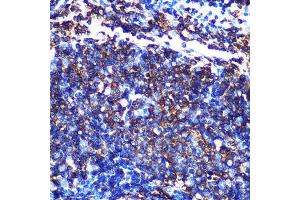 Immunohistochemistry of paraffin-embedded mouse spleen using HLA-DQ Rabbit mAb (1252) at dilution of 1:100 (40x lens). (HLA-DQA1 antibody)