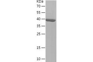 Western Blotting (WB) image for L-2-Hydroxyglutarate Dehydrogenase (L2HGDH) (AA 80-249) protein (His-IF2DI Tag) (ABIN7284033) (L2HGDH Protein (AA 80-249) (His-IF2DI Tag))