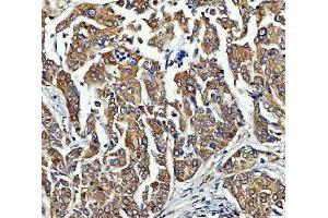IHC analysis of FRY using anti-FRY antibody (ABIN7599716). (FRY antibody  (AA 11-3013))
