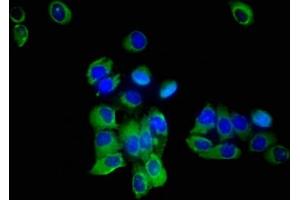 Immunofluorescent analysis of A549 cells using ABIN7170231 at dilution of 1:100 and Alexa Fluor 488-congugated AffiniPure Goat Anti-Rabbit IgG(H+L) (SLC35F2 antibody  (AA 335-374))