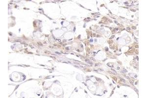 Immunohistochemistry (IHC) image for anti-Androgen Receptor (AR) (AA 15-246) antibody (ABIN7433333)