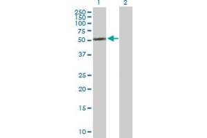 Western Blot analysis of CYP2R1 expression in transfected 293T cell line by CYP2R1 MaxPab polyclonal antibody. (CYP2R1 antibody  (AA 1-501))