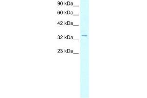 WB Suggested Anti-HOXD12 Antibody Titration:  5. (HOXD12 antibody  (N-Term))