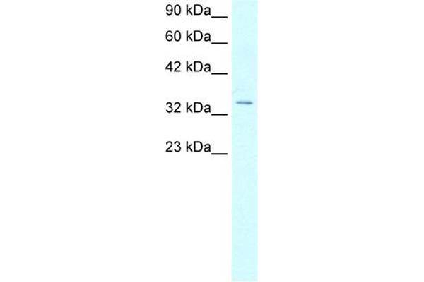 HOXD12 anticorps  (N-Term)