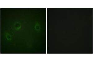 Immunofluorescence analysis of HeLa cells, using MARK1/2/3/4 (Ab-215) Antibody. (MARK1/2/3/4 antibody  (AA 181-230))