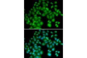 Immunofluorescence analysis of HeLa cells using TMSB4X antibody (ABIN3213357). (TMSB4X antibody)