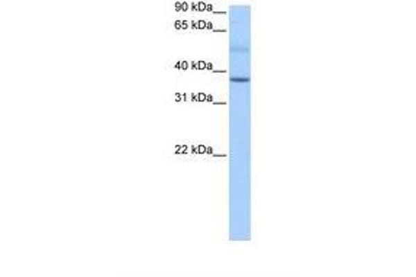 SERTAD2 antibody  (AA 43-92)