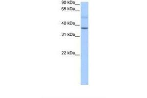 SERTAD2 antibody  (AA 43-92)
