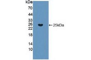Detection of Recombinant KRAS, Human using Polyclonal Antibody to V-Ki-Ras2 Kirsten Rat Sarcoma Viral Oncogene Homolog (KRAS) (K-RAS antibody  (AA 1-189))