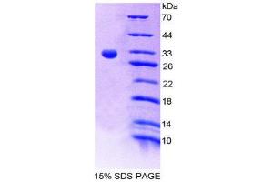 SDS-PAGE (SDS) image for Ribonuclease T2 (RNASET2) (AA 32-259) protein (His tag) (ABIN1080678)