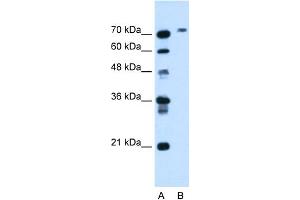 WB Suggested Anti-BCHE Antibody Titration:  1. (Butyrylcholinesterase antibody  (N-Term))