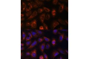 Immunofluorescence (IF) image for anti-Carbamoyl-Phosphate Synthetase 2, Aspartate Transcarbamylase, and Dihydroorotase (CAD) (AA 1650-1900) antibody (ABIN6137837)