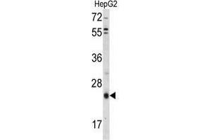 Western blot analysis of TIMP3 Antibody (Center) in HepG2 cell line lysates (35 µg/lane).