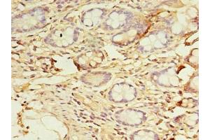 Immunohistochemistry of paraffin-embedded human small intestine tissue using ABIN7150796 at dilution of 1:100 (DYRK4 antibody  (AA 201-520))