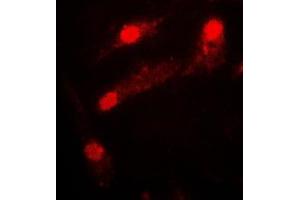 Immunofluorescent analysis of LIMK2 staining in COLO205 cells. (LIMK2 antibody  (Center))