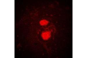 Immunofluorescent analysis of FRK staining in K562 cells. (FRK antibody  (Center))