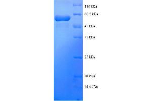 Tetratricopeptide Repeat Domain 1 (TTC1) (AA 3-292), (partial) protein (GST tag)