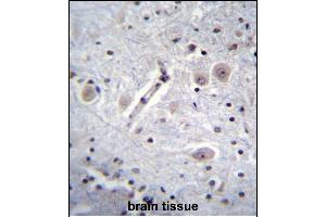 RK Antibody (C-term) (ABIN652301 and ABIN2841363) immunohistochemistry analysis in forlin fixed and paraffin embedded hun brain tissue followed by peroxidase conjugation of the secondary antibody and DAB staining. (MARK1 antibody  (C-Term))