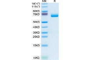 MPL Protein (AA 26-482) (His tag)