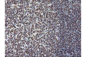 Image no. 13 for anti-F-Box Protein 21 (FBXO21) antibody (ABIN1498233) (FBXO21 antibody)